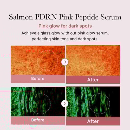 PDRN pink peptide serum MEDiCUBE